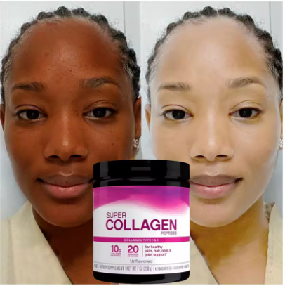 BIOTINE NATURELLE COLLAGENE + VITAMINE C