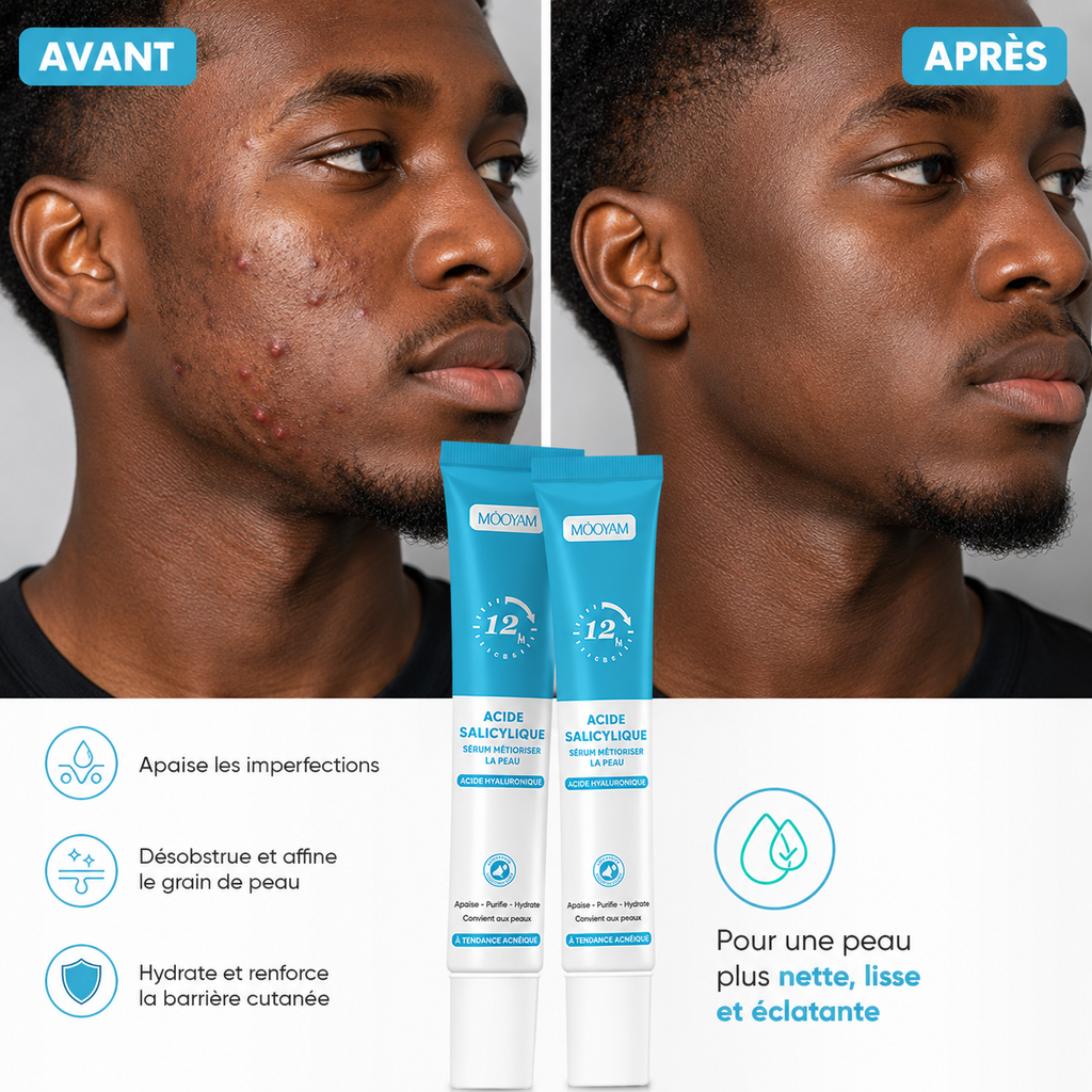 Crème anti-acné à l'acide salicylique 11500F