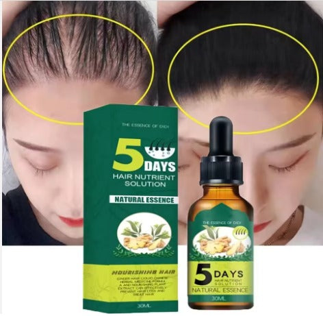 EELHOE: HUILE DE GINGEMBRE ANTI PERTE DE CHEVEUX