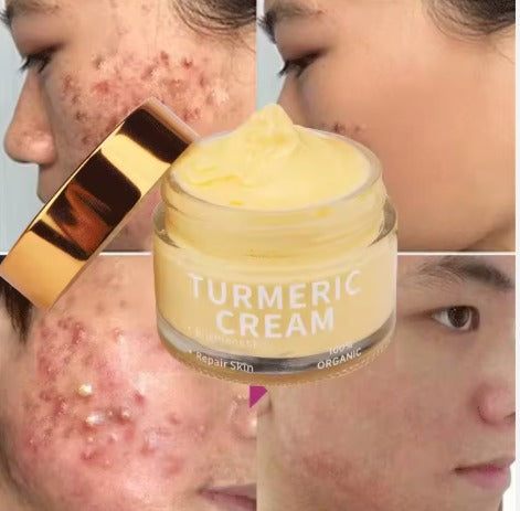 Crème Visage Hydratante au Curcuma & Vitamine C Naturelle  Prix : 15 000 F CFA